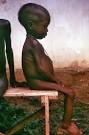 Getting to the Guts of Malnutrition - ScienceNOW