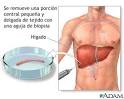 <b>Biopsia</b> de hígado: