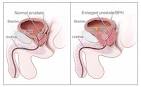 What causes painful urination in older men?