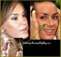 Tara Palmer-Tomkinson has recently undergone reconstructive surgery after ... - 1588337026_small