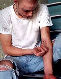 But what makes Heroin so dangerous?