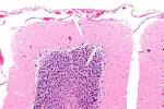 File:<b>Cerebellar cortex</b> - intermed mag.jpg - Wikimedia Commons