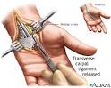 The <b>surgery</b> is straightforward