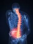<b>Low back pain</b> is one of the
