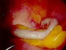 Appendix