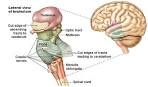 <b>brain stem</b>