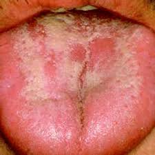 babies diseases