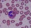 Eosinophil granulocyte - Wikipedia, the free encyclopedia