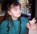 Cornelia <b>de Lange syndrome</b>: