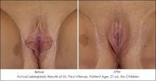 http://t1.gstatic.com/images?q=tbn:ANd9GcRbA-Ezt7U1G0p404noOzYXrns9qaFqIP4NYVapW2FtUfdwG-9lavqxNuuu