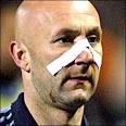 Marseille's on-loan keeper Fabien Barthez sports a bandage after a blow in ... - _39966209_barthez_gi300x300