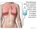 Lung Cancer - Non-Small Cell Chemotherapy Treatments - Lung Cancer ...