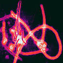 MicrobiologyBytesFilovirus » MicrobiologyBytes