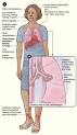 220px-<b>Sarcoidosis</b>_signs_and_ ...