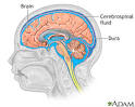 <b>Cerebrospinal fluid</b> leak