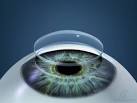 Ceratocone, ectasia, ectasia corneal, ectasia corneana, tratamento para ceratocone, cura para ceratocone, ceratocone avançado, ceratocone inicial, suspeita de ceratocone, lente para ceratocone, especialista em ceratocone, especialista ceratocone porto alegre, clinica especializada em ceratocone, oftalmologista ceratocone, oftalmologista para ceratocone, especializado em ceratocone, cone, córnea fina, cornea fina, córnea em forma de cone, cornea em forma de cone, ceratocone tratamento, ceratocone cirurgia, crosslink, cross link, crosslinking, cross linking, anel de ferrara, transplante de córnea, transplante de cornea
