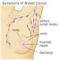 Breast pain