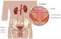 Chronic <b>Pelvic Pain</b>