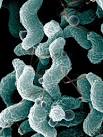 File:Campylobacter.jpg - Wikipedia, the free encyclopedia