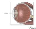 <b>Cornea</b>
