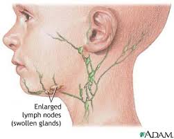 الجهاز المناعي Le système immunitaire  Images?q=tbn:ANd9GcRiX2XWyylLAQ2WN_A8jsvC_WWAt5YrLk-LHWYMRAZ8f0AH-esypg