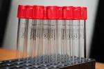 Test tubes — Fotopedia - via Daymix