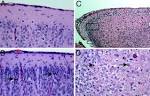 Transgenic mouse model for echovirus myocarditis and paralysis