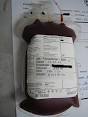 <b>Bone marrow transplant</b>