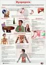 Photos related to Dyspepsia