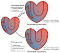 <b>Hypertrophy</b> hearts 500 July07