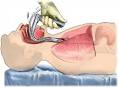 What is <b>Intubation</b> And Mechanical Ventilation | <b>Intubation</b> And
