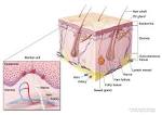 <b>Merkel cell carcinoma</b> starts