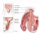 AUAF - Urology A-Z - Hydroceles and Inguinal Hernias