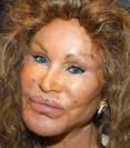 Is Plastic Surgery Abroad Safe? | One Face In A Million