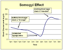 Chronic Somogyi rebound - Wikipedia, the free encyclopedia