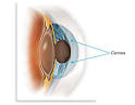 The <b>cornea</b> is the transparent