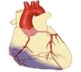 Rehabilitacion de infarto