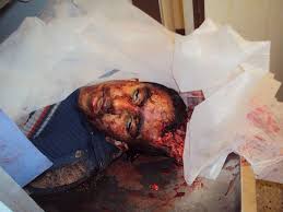 بالصور قصف طيران حربي على المتظاهرين السلميين في ليبيا ووقوع مجازر Images?q=tbn:ANd9GcRsA6CSc62ZGjUayMmH2eXMruFg0spZPk6ZwgvyQAyKumYn0MZX