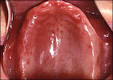 afp20081001p845 f7 <b>Denture</b>