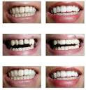 Dental surgery | Dental xrays
