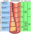 of atherosclerosis (size