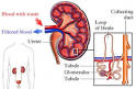 <b>Nephrotic syndrome</b> is not a
