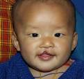 ... surgeons Drs. Jack Demos, Sarah Pettrone and Marc Liang's examination. - Bhutan-2010-005a