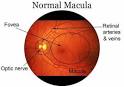 macular degeneration,