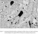 of <b>pestiviral infection</b>