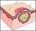 InfoDerm