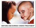 Chemo" Treatment