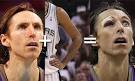 Duncan's(notes) left elbow