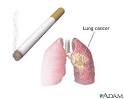 How To Quit Smoking – Why Hypnosis Is Safe And Effective
