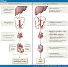 <b>hepatorenal syndrome</b>.